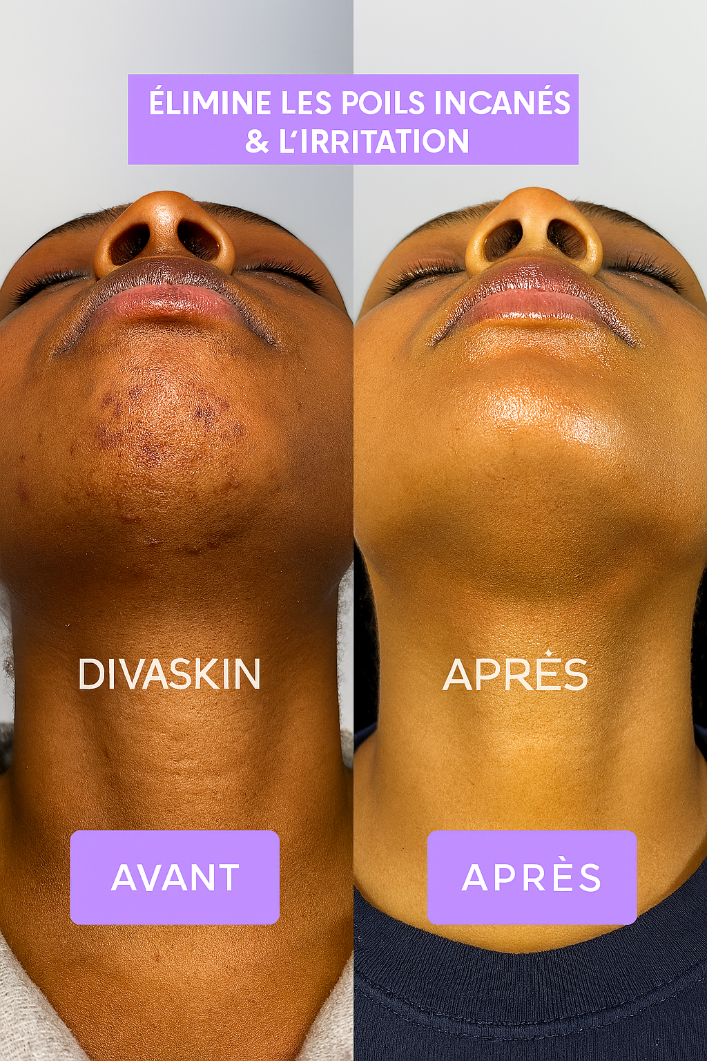 DIVAGLOW™ | Sérum Anti-Repousse Naturel | Huile post-épilation Zones Sensibles